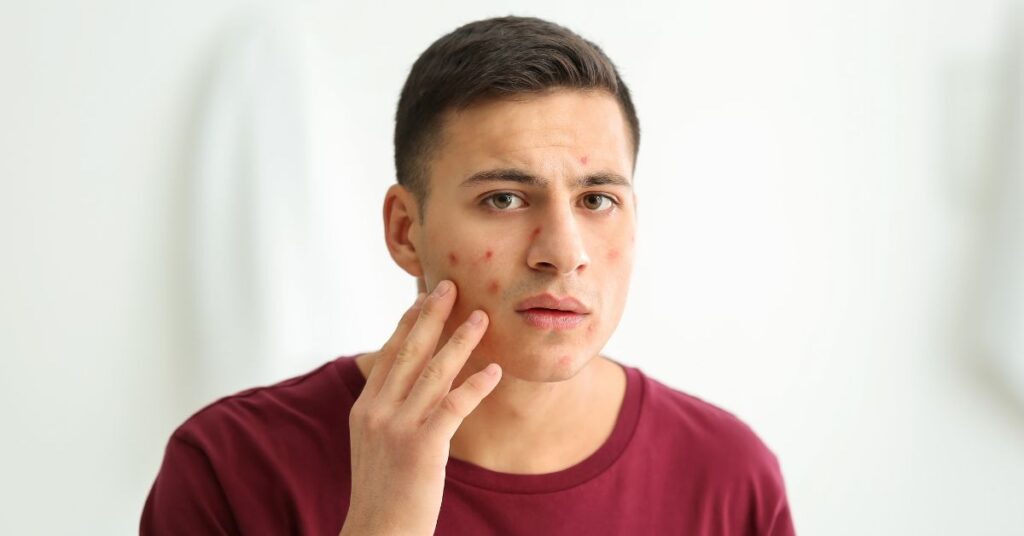 High Testosterone: Mood, Energy, and Behavioral Symptoms